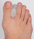 Tynor Toe Separator Silicon (Pair)